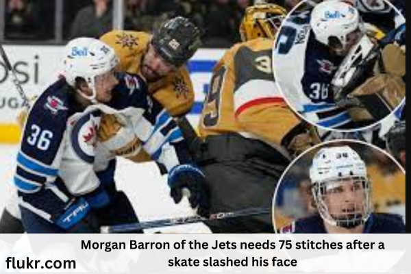 Morgan Barron of the Jets needs 75 stitches after a skate slashed his face